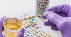 ¿Qué color debe tener la orina según los expertos ? ¿Qué color debe tener la orina según los expertos ?